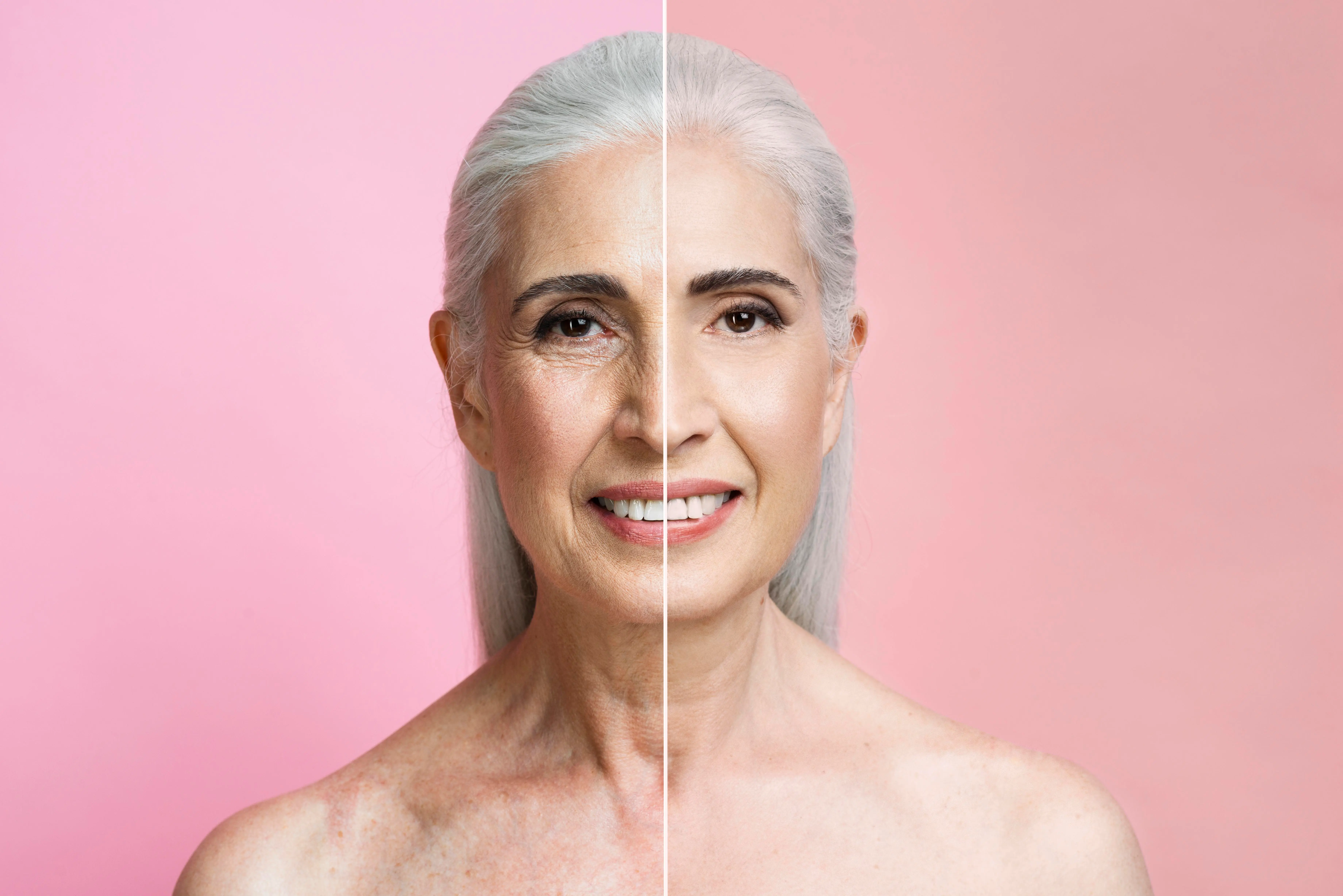 Facelift Surgery: A Comparative Guide between Turkey and the United Kingdom β¨πββοΈπ